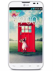 LG L70 Dual D325